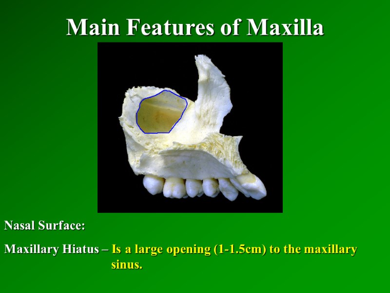 Main Features of Maxilla   Nasal Surface: Maxillary Hiatus – Is a large